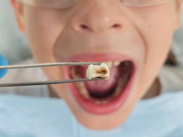 Best Emergency Broken Tooth Repair in Wallburg, NC
