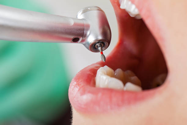 Best Emergency Dental Surgery in Wallburg, NC